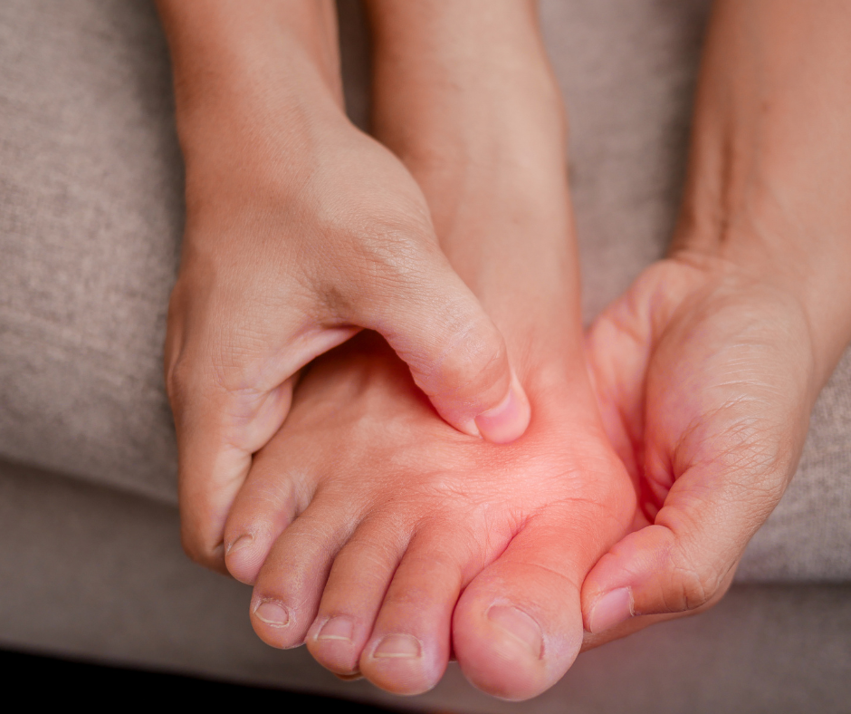 foot with bunion