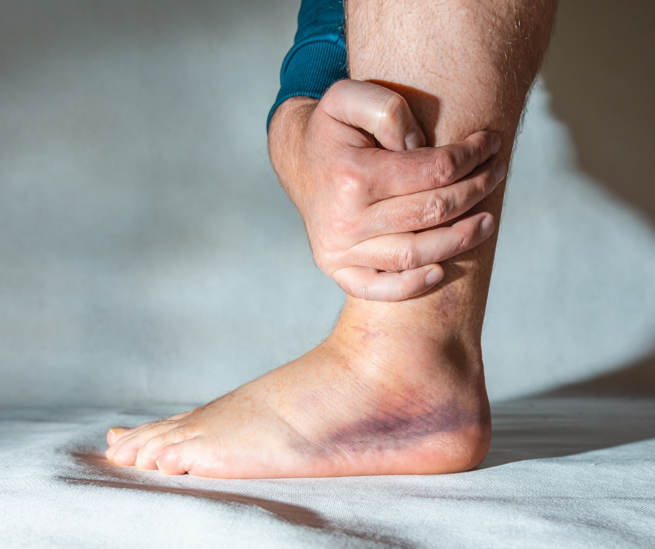 {posthttps://valleypodiatry.com/blog/do-i-need-a-doctor-for-a-sprained-ankle/Do I Need a Doctor for a Sprained Ankle? _title}